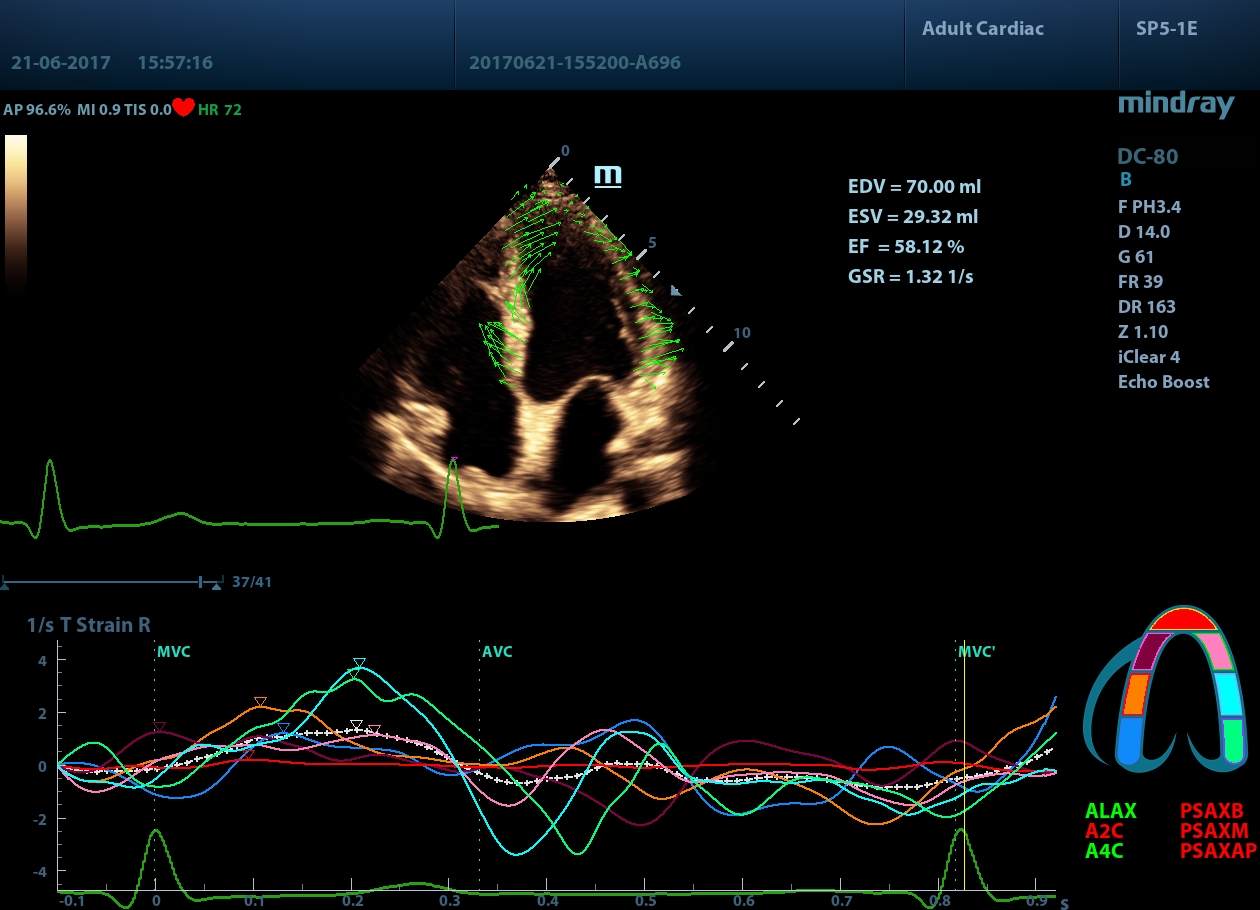 УЗИ аппарат Mindray DC-804