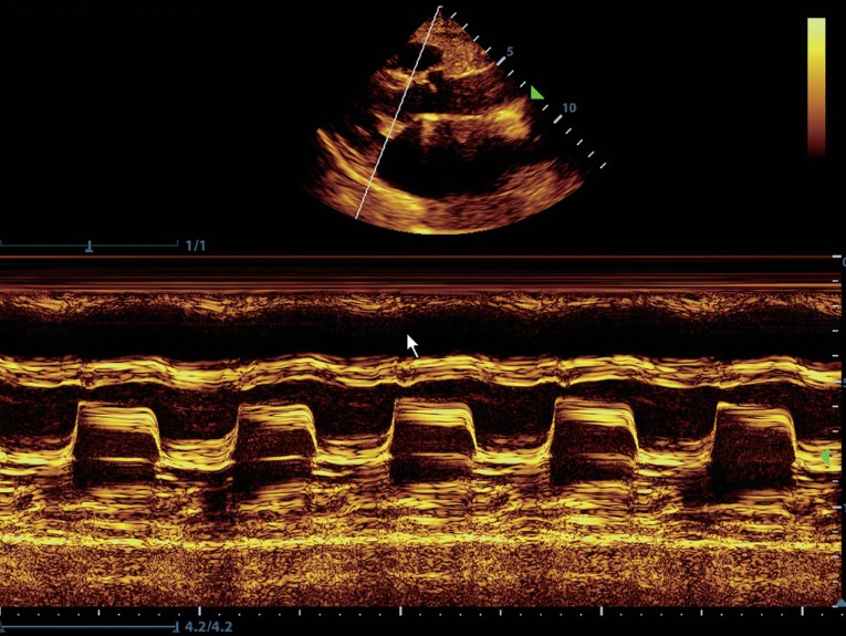 УЗИ аппарат Mindray M8 портативный6