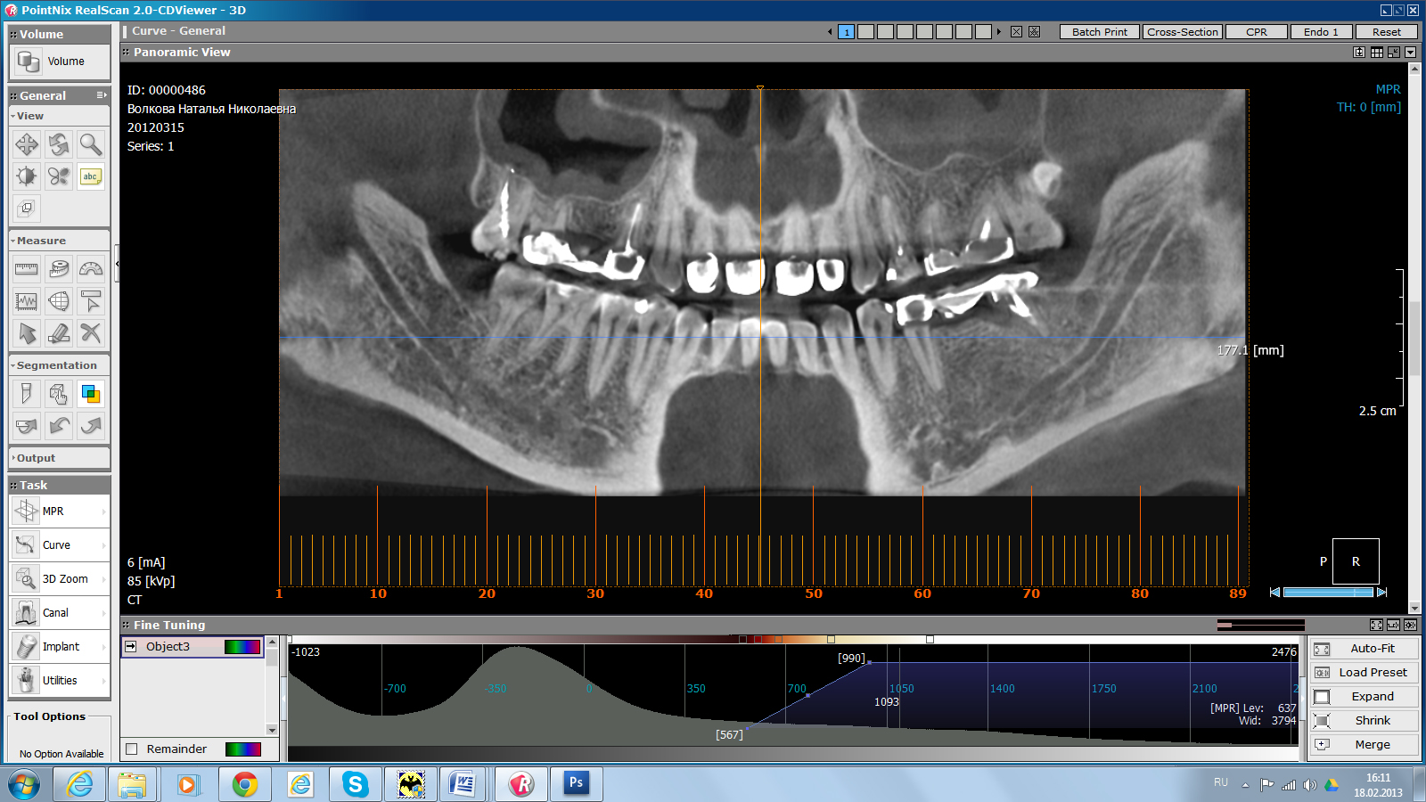 PointNix 3D Combi 500 16x9 дентальный компьютерный томограф2