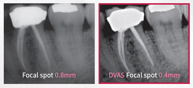 Система рентгеновская интраоральная Genoray DVAS-C с креплением к полу3