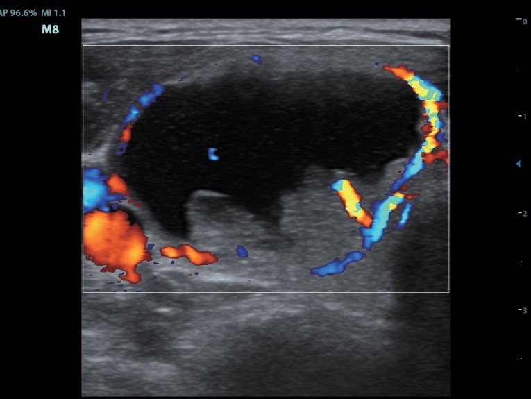 УЗИ аппарат Mindray M8 портативный2