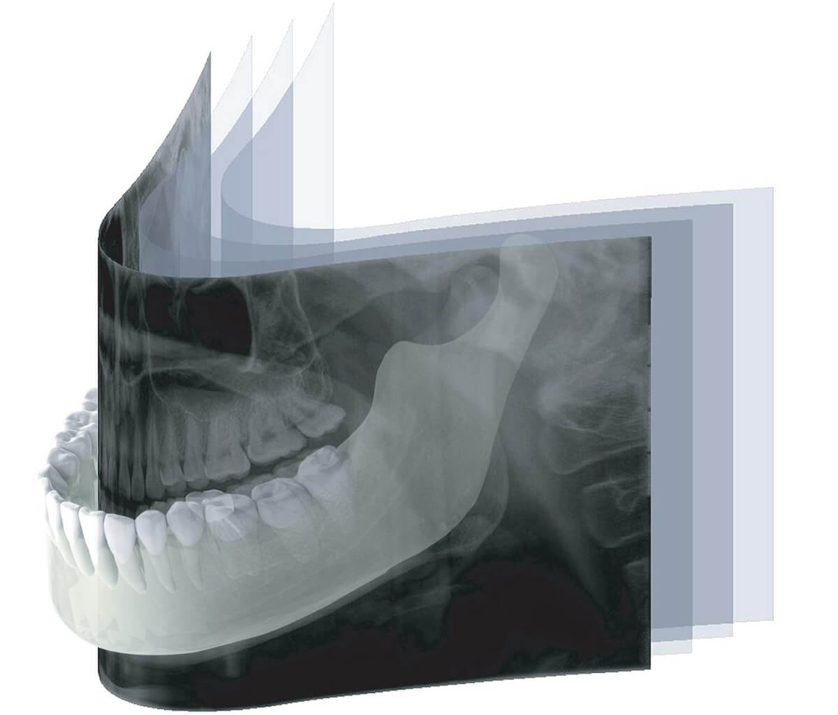 Ортопантомограф Genoray Papaya с функцией CUST3 Ортопантомограф Genoray Papaya с функцией CUST3