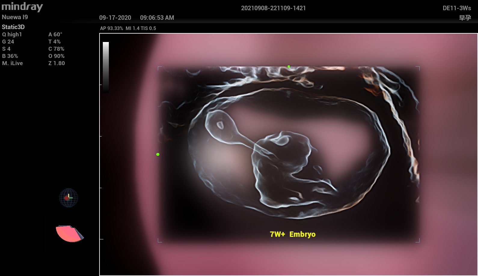 УЗИ аппарат Mindray Imagyn I91