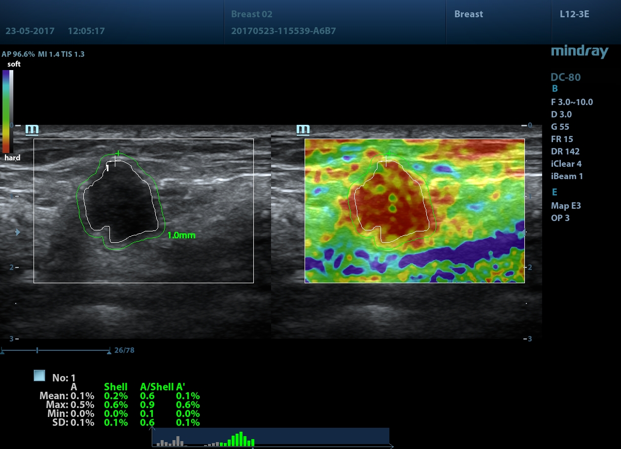 УЗИ аппарат Mindray DC-803