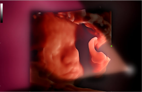 УЗИ аппарат Mindray Consona N82 УЗИ аппарат Mindray Consona N82