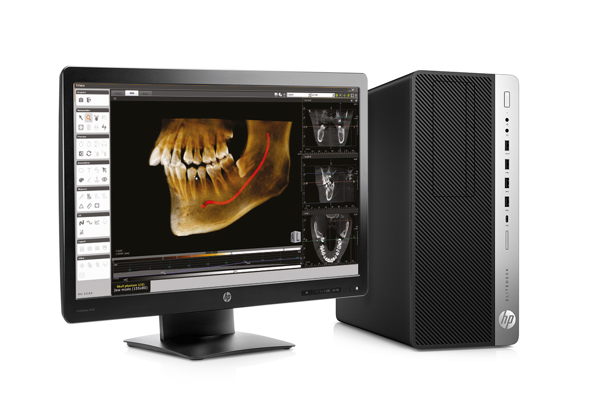 Genoray Papaya 3D 16x14 – дентальный компьютерный 3D-томограф3