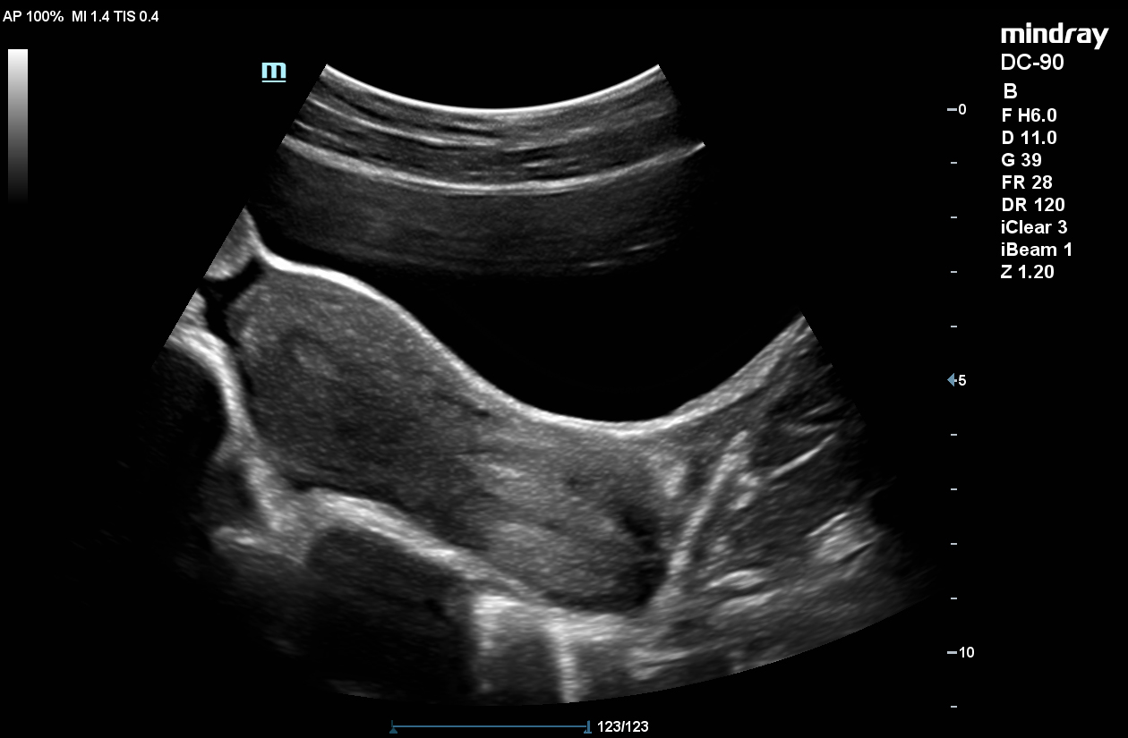 УЗИ аппарат Mindray DC-90 X-insight 3