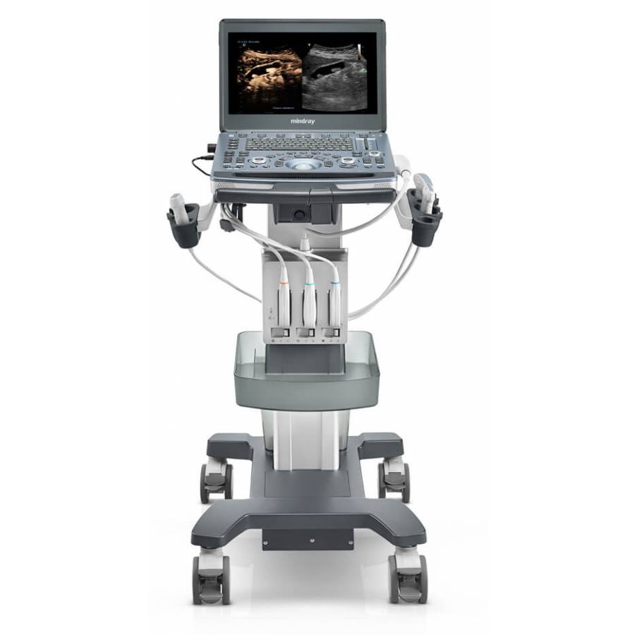 УЗИ аппарат Mindray M8 портативный УЗИ аппарат Mindray M8 портативный