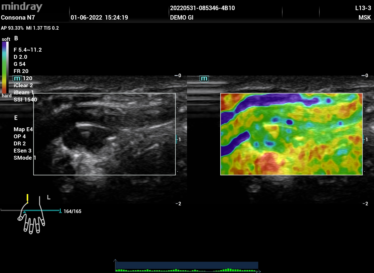 УЗИ аппарат Mindray Consona N74