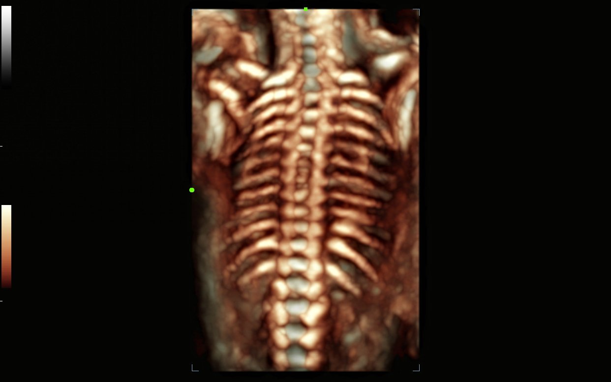 УЗИ аппарат Mindray Consona N91