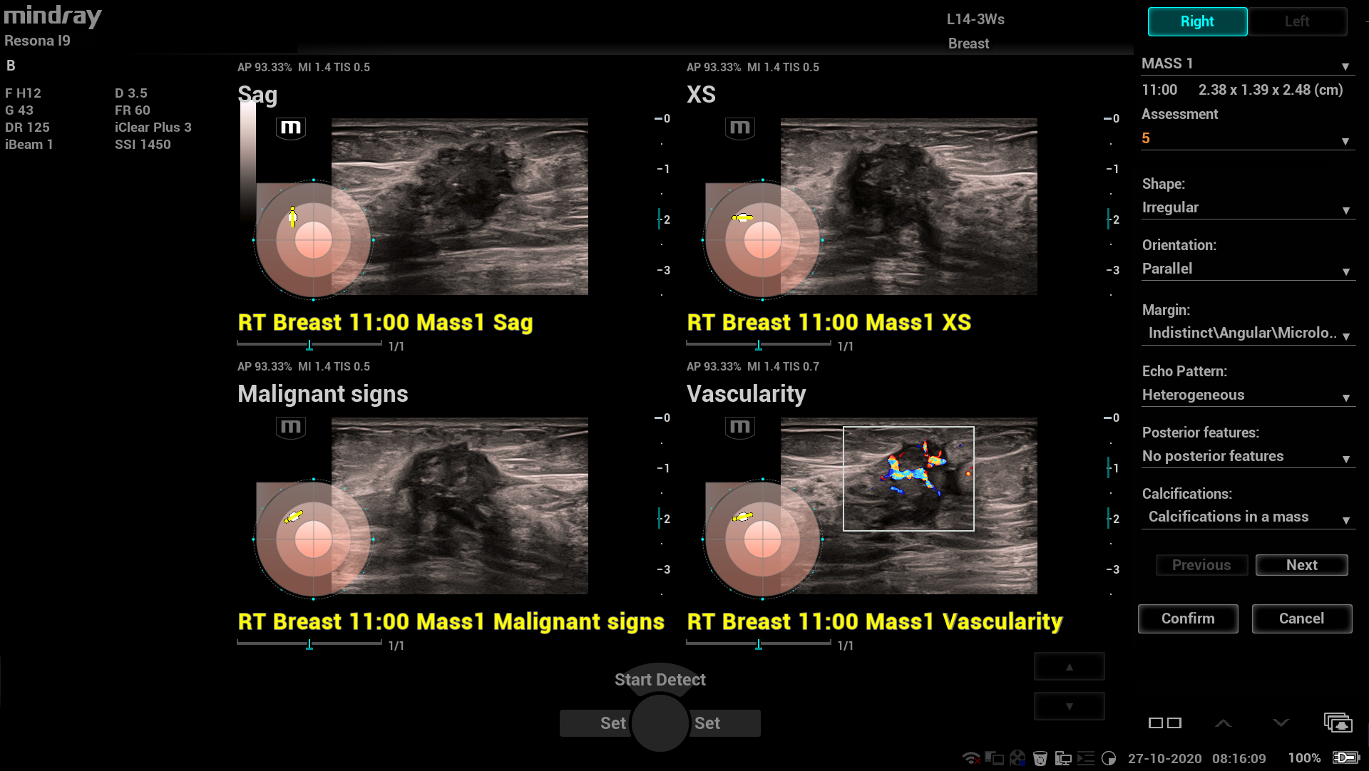 УЗИ Mindray Resona I91