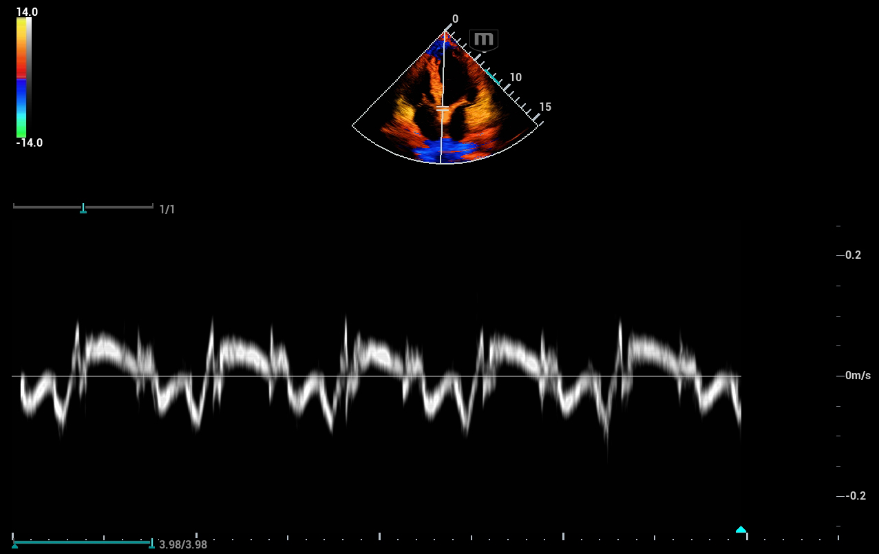УЗИ аппарат Mindray Consona N93