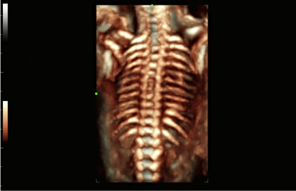 УЗИ аппарат Mindray Consona N83 УЗИ аппарат Mindray Consona N83