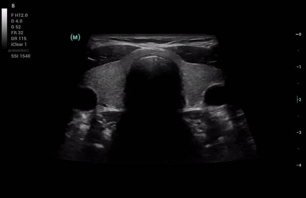 УЗИ аппарат Mindray Consona N81