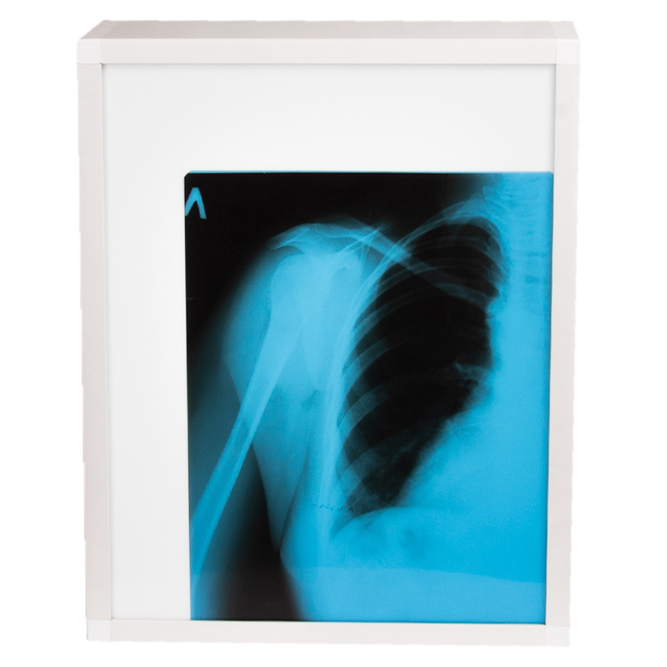 Люминесцентный негатоскоп ТАГЛЕР НЛ-12