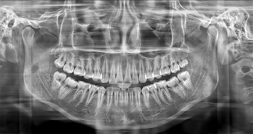 Томограф Meyer 3D Pro 16x102 Томограф Meyer 3D Pro 16x102