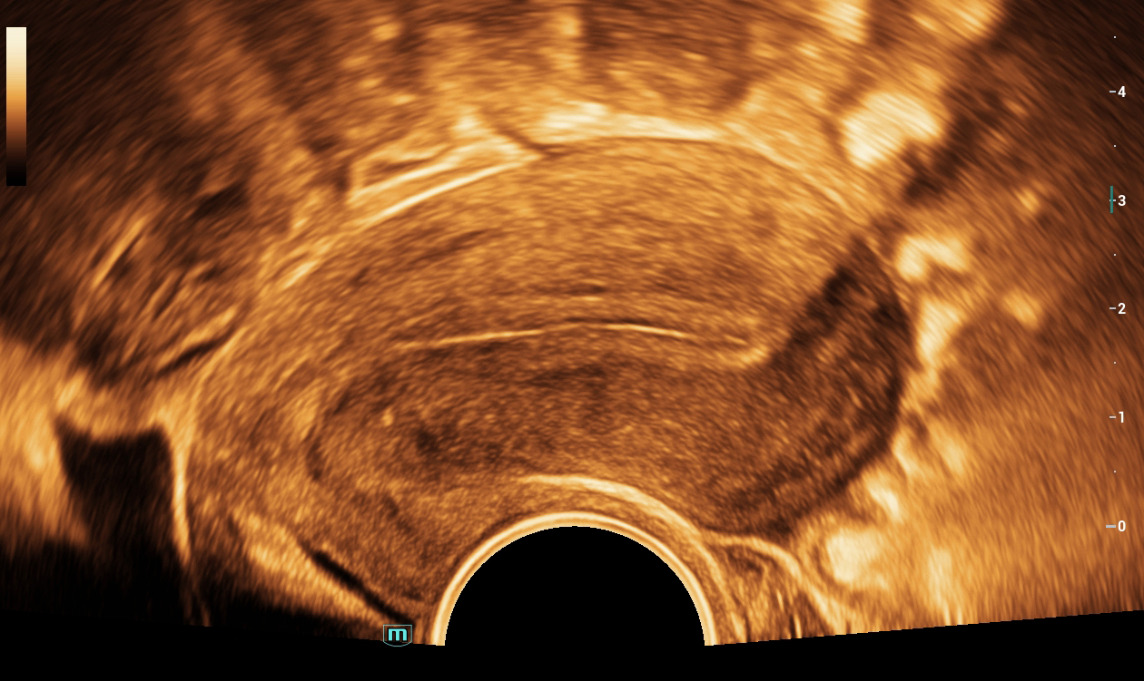 УЗИ аппарат Mindray Consona N92 УЗИ аппарат Mindray Consona N92