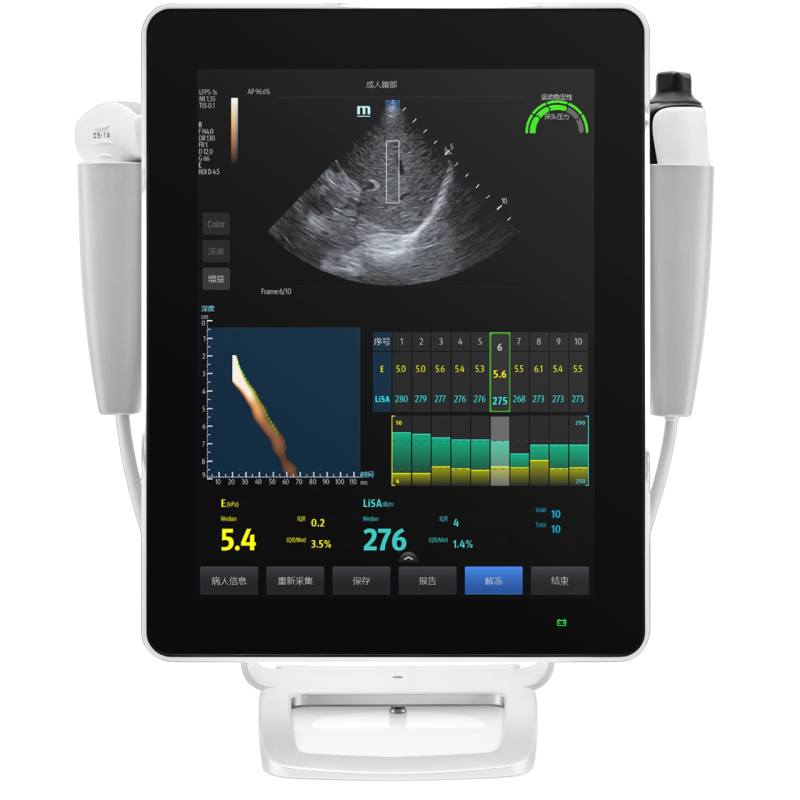 УЗИ система фибросканирования печени Mindray Hepatus