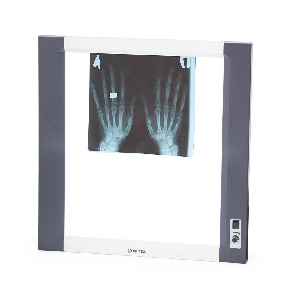 Негатоскоп общего назначения Армед 1-кадровый