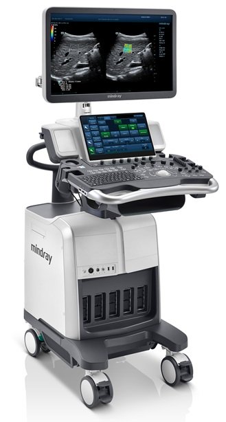 УЗИ аппарат Mindray DC-80