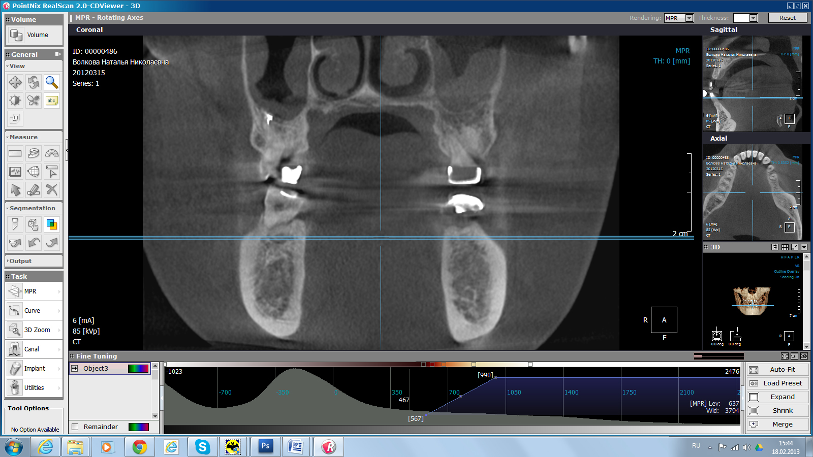 PointNix 3D Combi 500 16x9 дентальный компьютерный томограф3