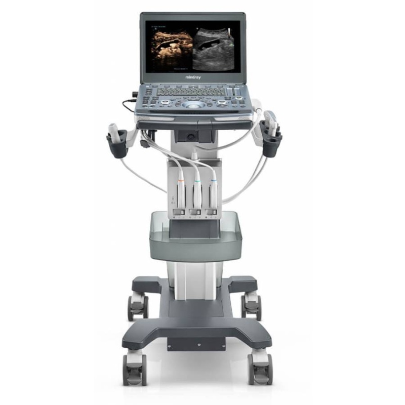 УЗИ аппарат Mindray M8 портативный