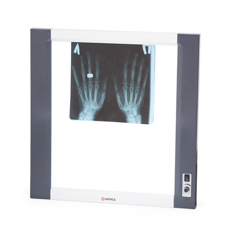 Негатоскоп общего назначения Армед 1-кадровый