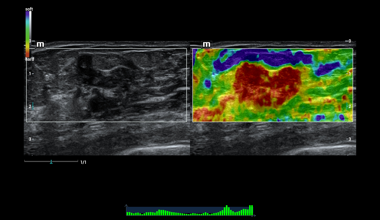 УЗИ Mindray Resona I94