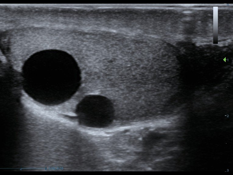 УЗИ аппарат Mindray M8 портативный5
