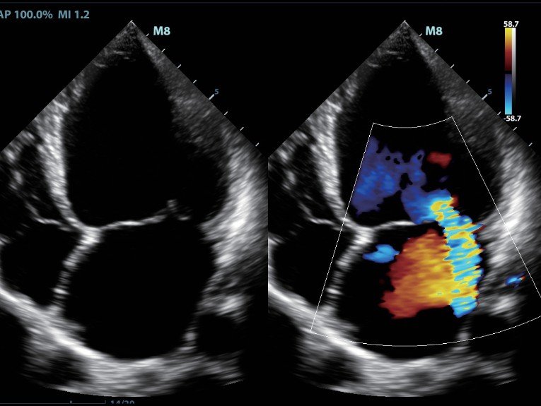 УЗИ аппарат Mindray M8 портативный7